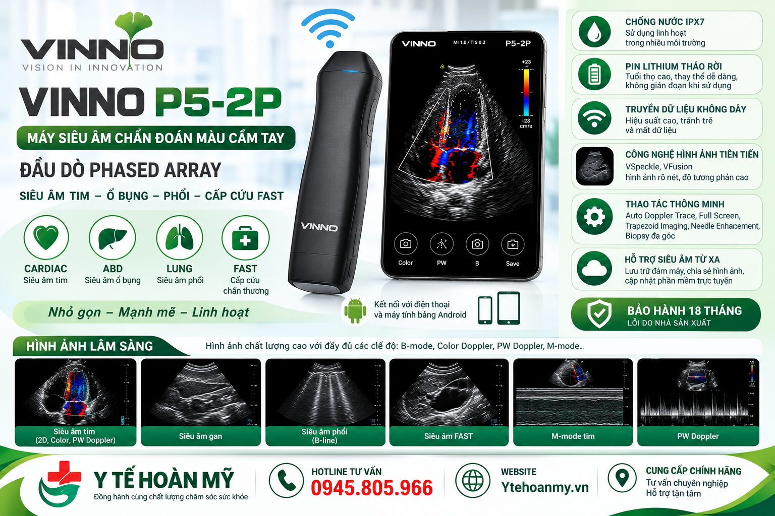 M&aacute;y si&ecirc;u &acirc;m cầm tay chẩn đo&aacute;n m&agrave;u VINNO P5-2P